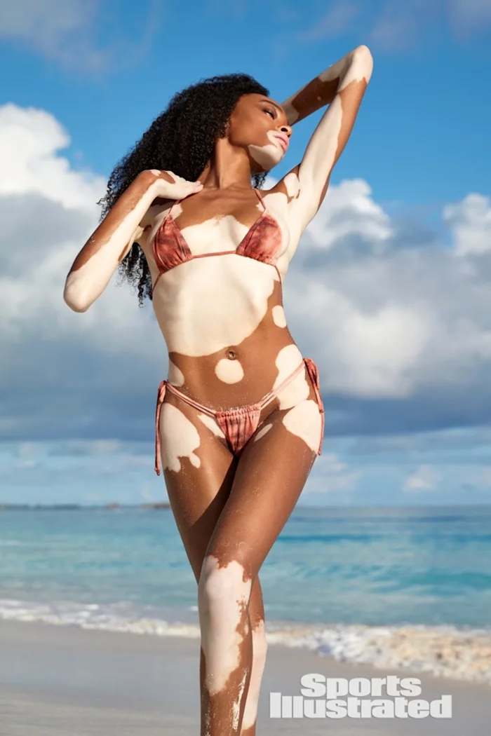 Winnie Harlow stands in front of the ocean wearing a pink tie-dyed string bikini.